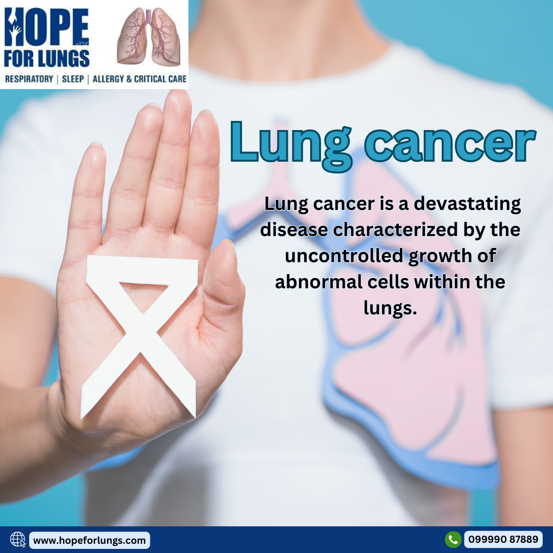 Lung Cancer